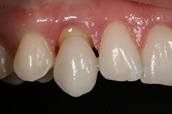 Dental Implant Dentists