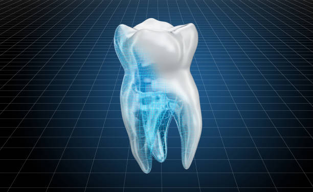 CAD Technology To Restore Your Teeth